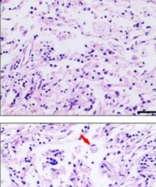 CD4 T细胞增殖，揭秘免疫系统核心机制