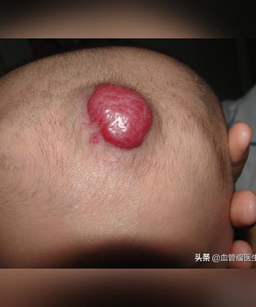 揭秘真相，血为什么是红色的？百度权威解答！