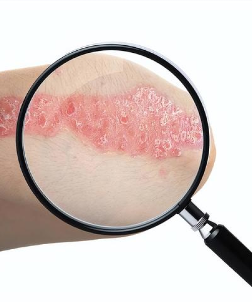 全球HIV科研投入排名揭秘，抗击艾滋病的力量分布与地域差异